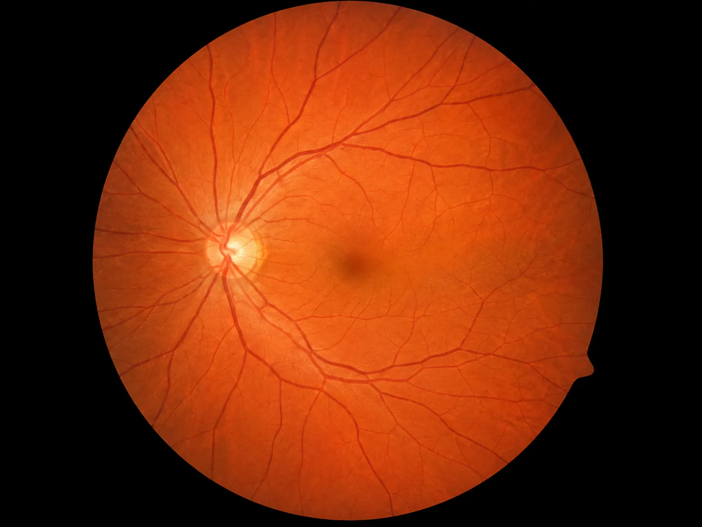 Schritt 3: Fundus-Untersuchung