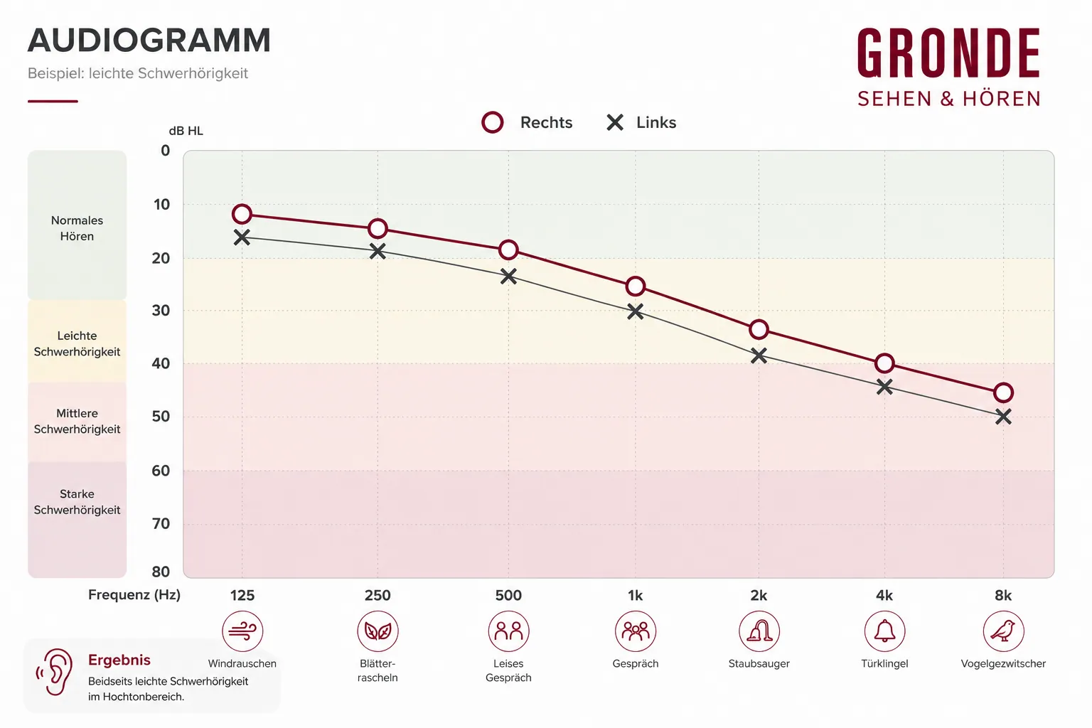 Audiogramm Beispiel · leichte Schwerhörigkeit
