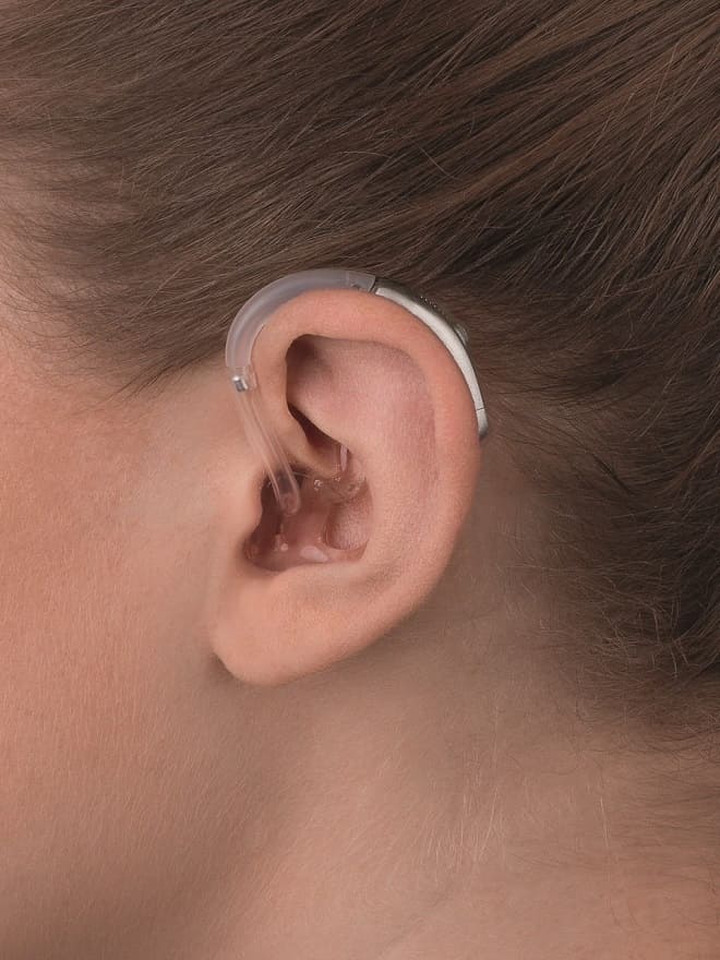 junge Frau mit klassischem Hinter-dem-Ohr-Hörgerät auch für hochgradigen Hörverlust. Bei Hörakustik Gronde